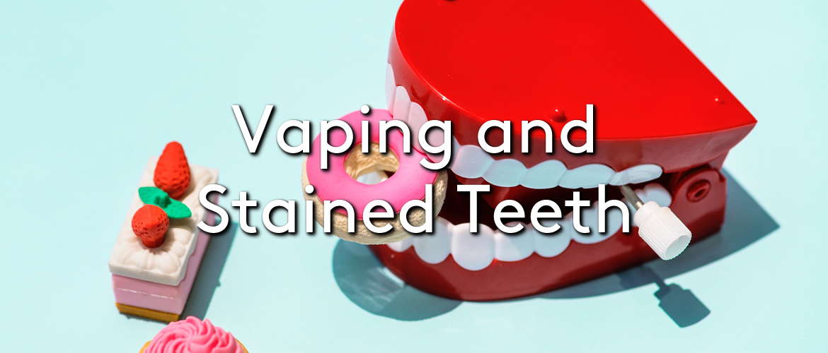 Vaping and Stained Teeth